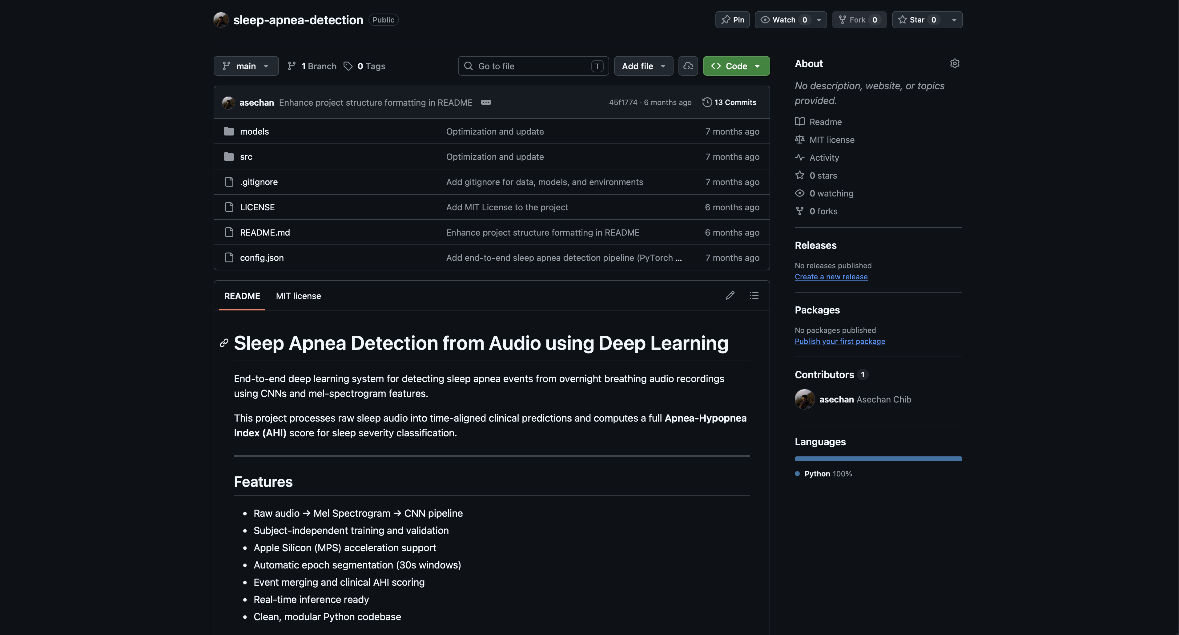 Sleep Apnea Detection System project preview